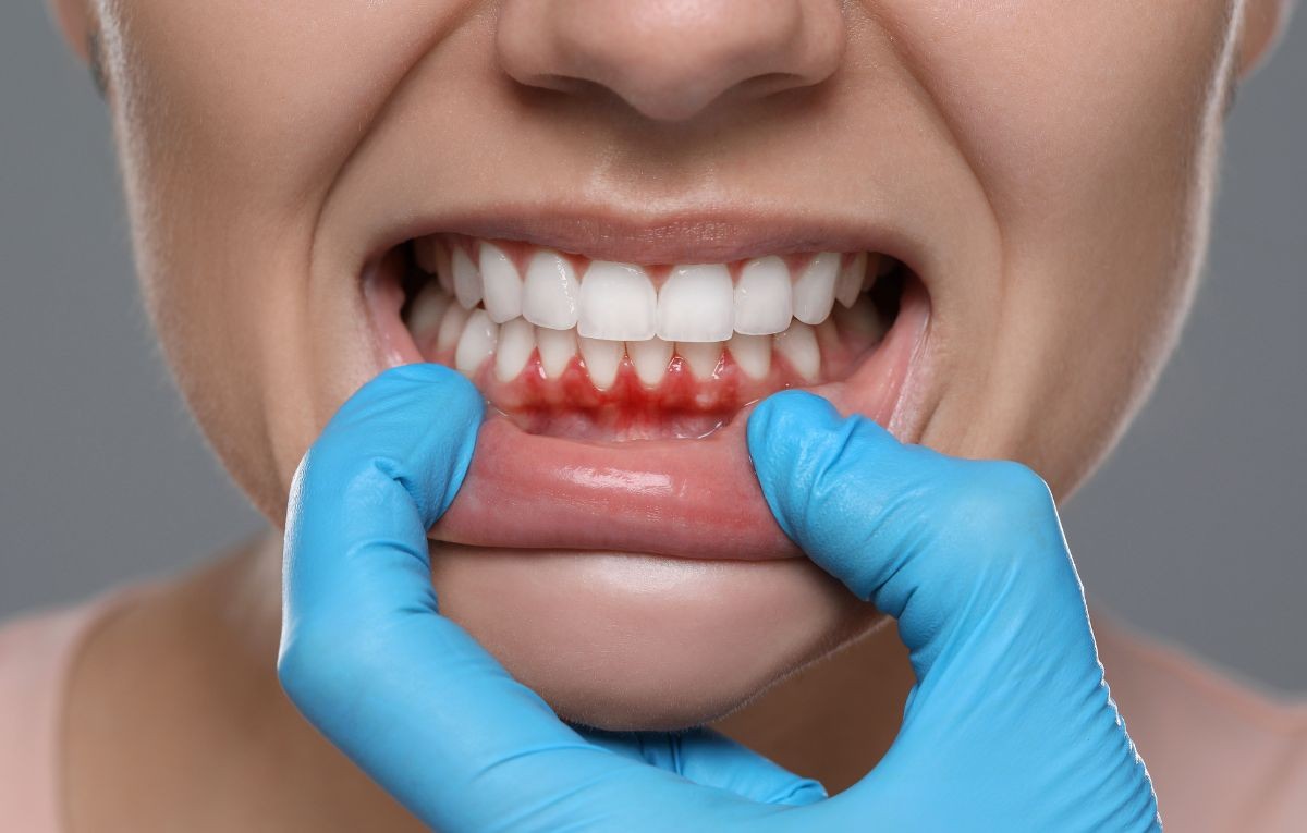 problemas-na-gengiva-descubra-como-a-periodontia-pode-ser-a-solucao-que-voce-precisa